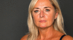 Skin condition sufferers have been ‘cast aside’