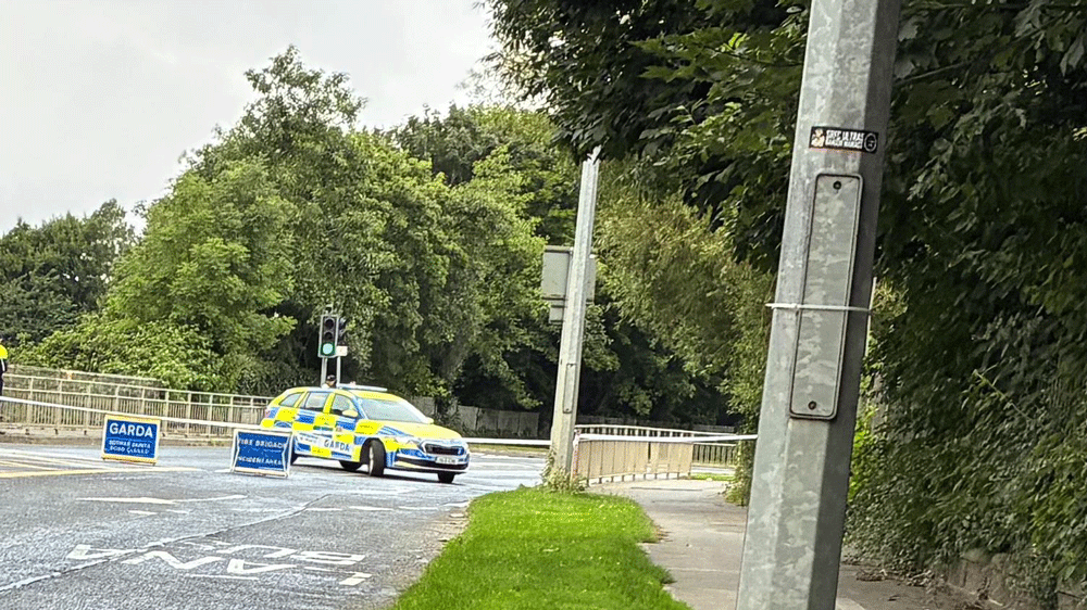 Cyclist in critical condition after being struck by car