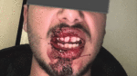 Student (25) attacked by youths with a metal pole