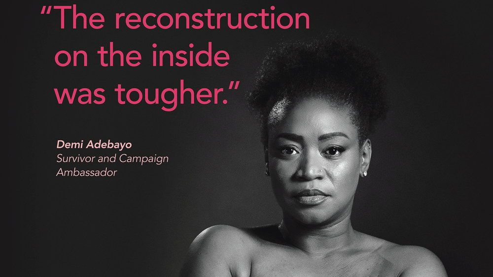 Brave faces of new breast cancer awareness campaign Brave faces of new breast cancer awareness campaign